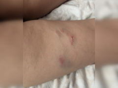 Горожанка рассказала о своре собак, искусавших ребенка в Заводском районе