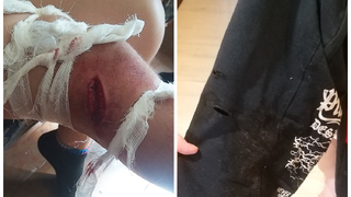 В Саратове огромная собака искусала ноги 8-летнему мальчику: следователи начали проверку