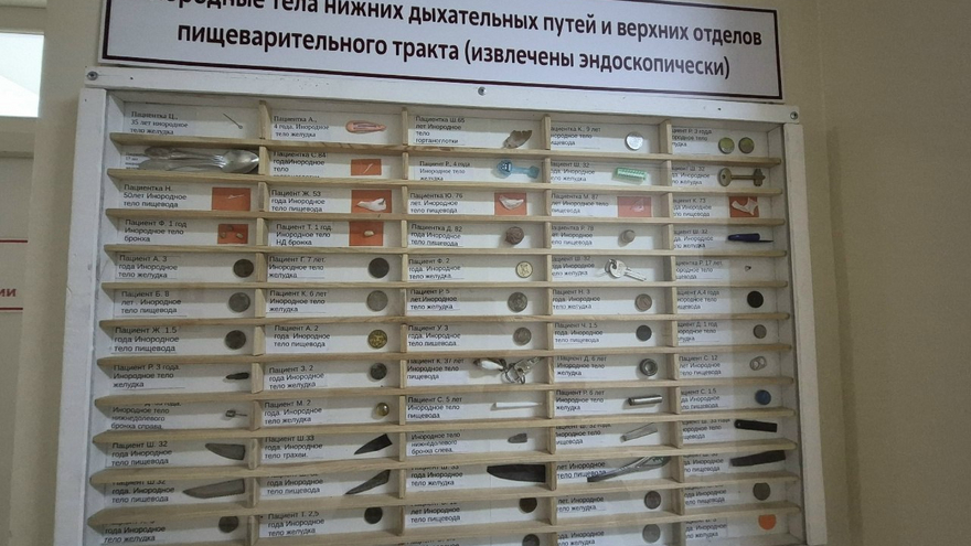В Саратовской области 20-летняя девушка проглотила пирсинг и попала в больницу