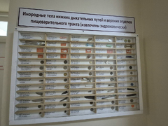 В Саратовской области 20-летняя девушка проглотила пирсинг и попала в больницу