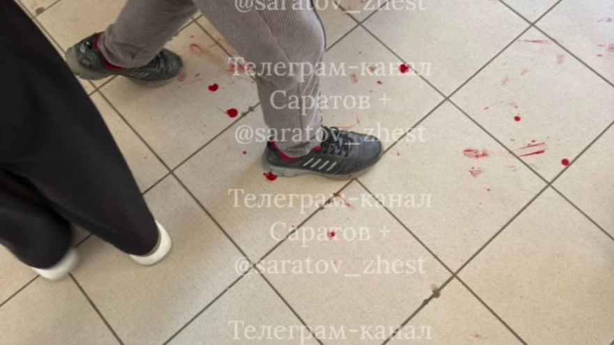 В Саратове школьник получил травму во время подвижных игр