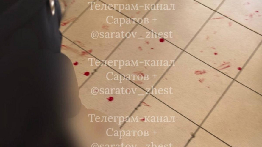 В Саратове школьник получил травму во время подвижных игр