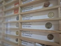 В Балакове врачи извлекли из желудка 4-летнего ребенка монету
