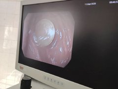 В Балакове врачи извлекли из желудка 4-летнего ребенка монету