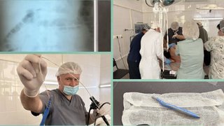 В Саратовской области мужчина проглотил часть ложки и ручку зубной щетки