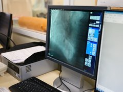 В сосудистом центре Энгельса спасли жизни 10 тысячам пациентов